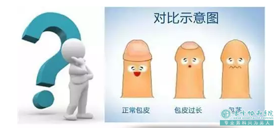 赤峰男人有包皮有什么影响